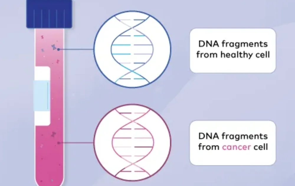 Multi-Cancer Early Detection | Absoultue Vitality